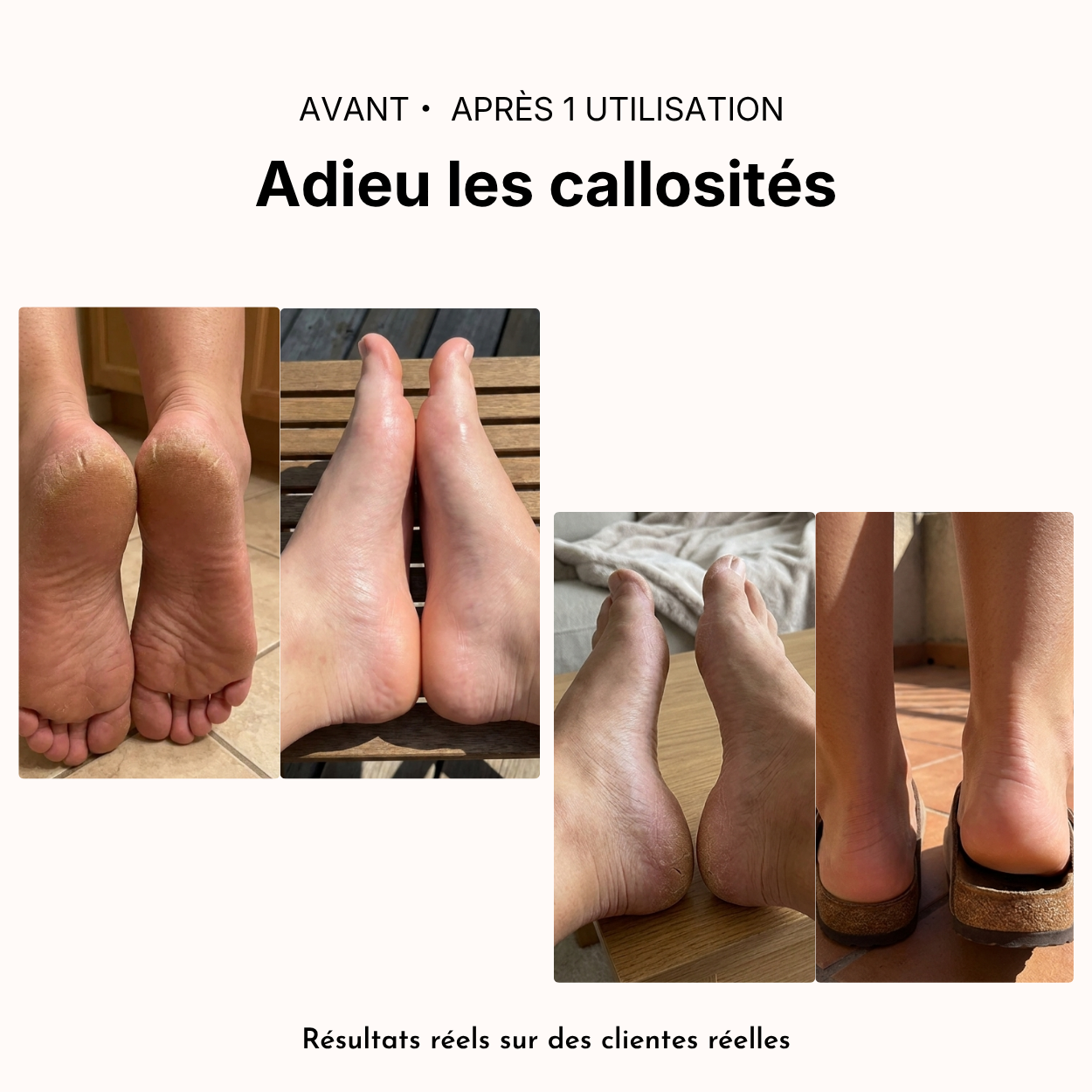 Kit beauté pieds